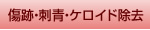 傷跡、刺青(タトゥー)、ケロイド除去