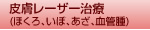 皮膚レーザー治療(ほくろ、いぼ、あざ、血管腫)